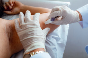 Lauro de Freitas: Saúde amplia acesso ao Implanon e já registra 490 inserções